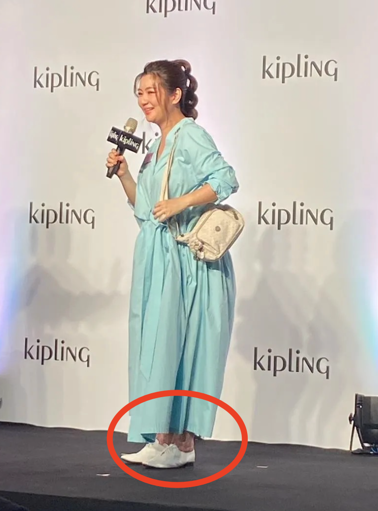 Selina|Selina和男友出游,挺孕肚过母亲节,大方晒出双腿烧伤疤痕不自卑