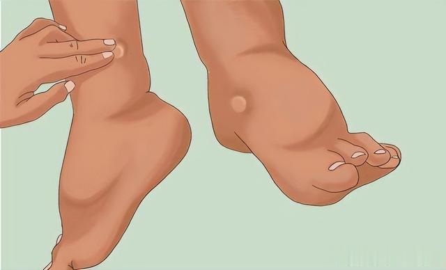 脾胃“阴毒”不除，越补越堵！3个中成药，横扫身体里的湿 痰 瘀