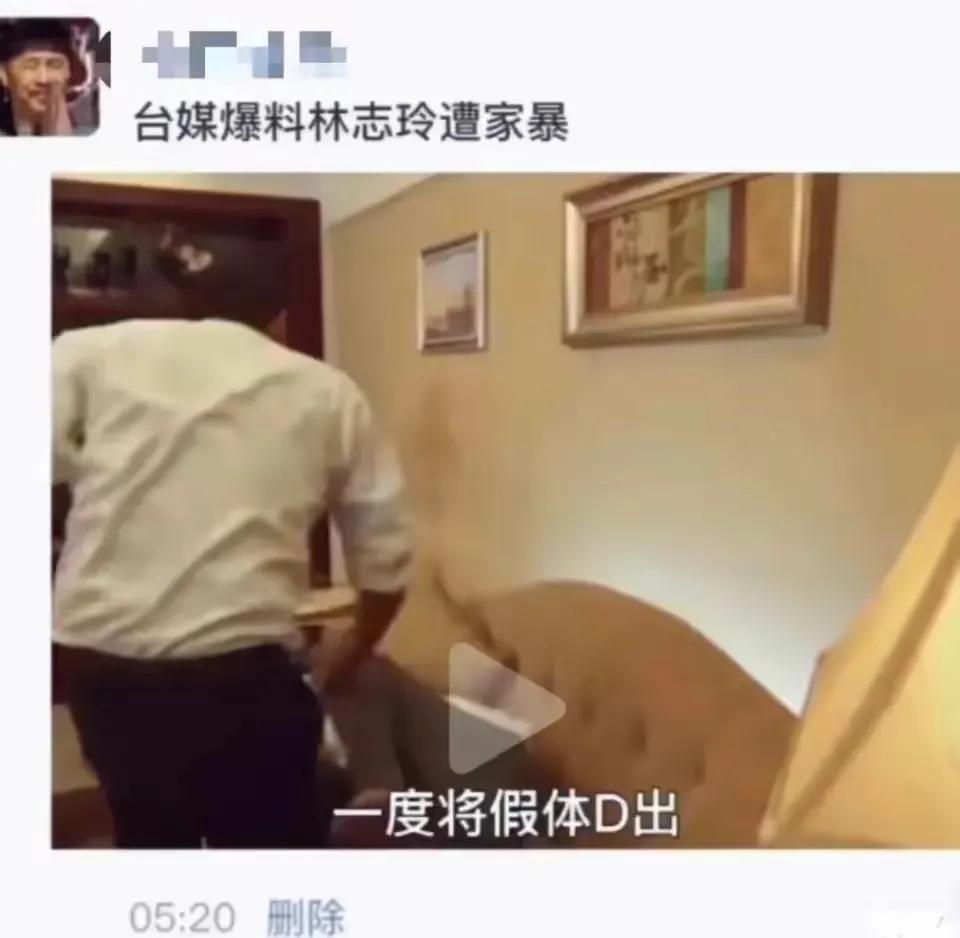 林志玲|台媒曝林志玲被老公家暴，假体被打出，男方疑长期出轨还动粗