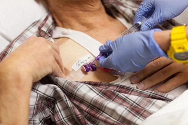 化疗，到底是救人还是害人？化疗后人就废了？医生说出真相