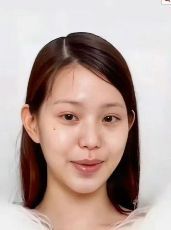 张元英素颜照曝光！整容痕迹超重，面部浮肿僵硬，瞬间老了20岁