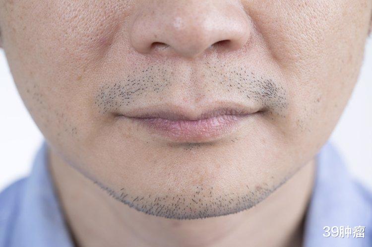 肺动脉高压|嘴唇颜色深,说明心血管不好?提醒:嘴唇出现3个变化,不算好事