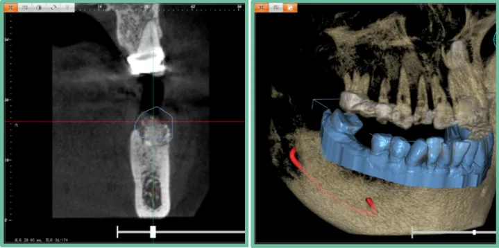 aiot|3D打印在口腔领域上的应用会在未来有明显的体现吗?