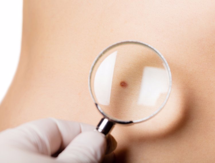 人乳头瘤病毒|脖子上长的“小肉粒”是什么？能直接用手揪掉吗？告诉你答案