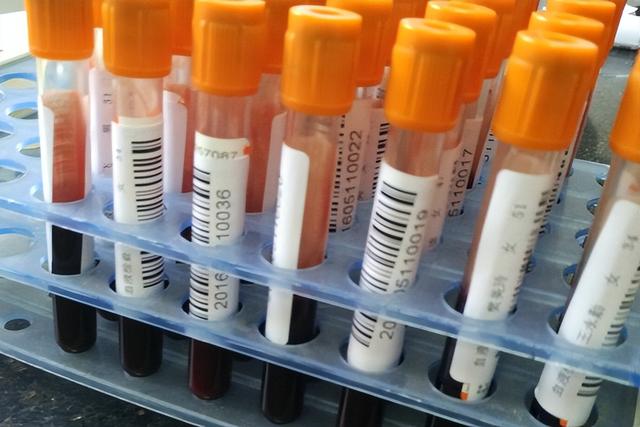 留个心眼！一旦身体出现3个症状，可能是梅毒