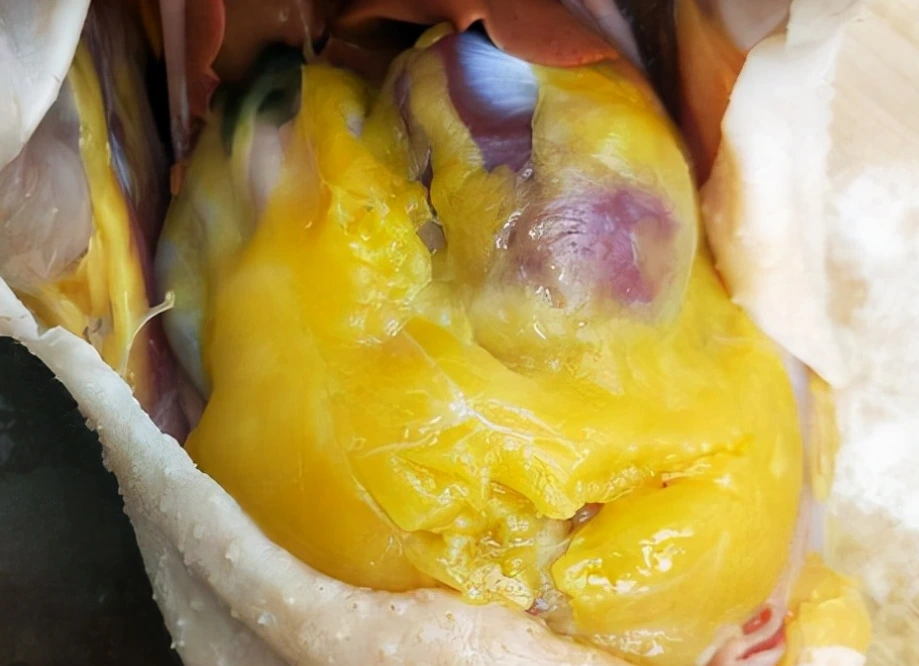 |杀鸡时,肚子里有一块“黄油”经常被扔掉,殊不知是个宝,网友:涨知识了