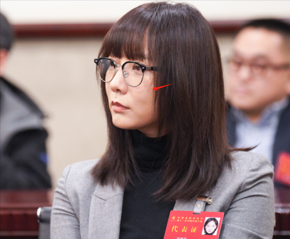 央视“照妖镜”又来了，痘坑脸、浮肿眼，明星的真实样貌全暴露了