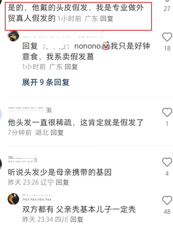 黄晓明《中餐厅》假发套穿帮,脖子上方头发奇怪,像戴了一顶帽子