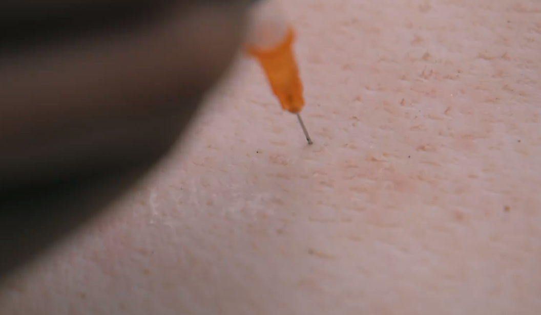 南风知我意:打针用猪皮做道具?突兀的转场,虚假中带着好笑