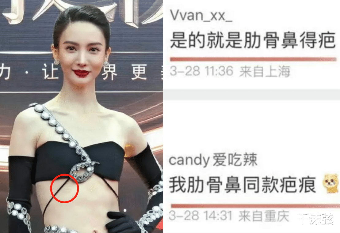 金晨整容后遗症上热搜！嘴歪斜下巴折叠，腰间肋骨鼻伤疤明显