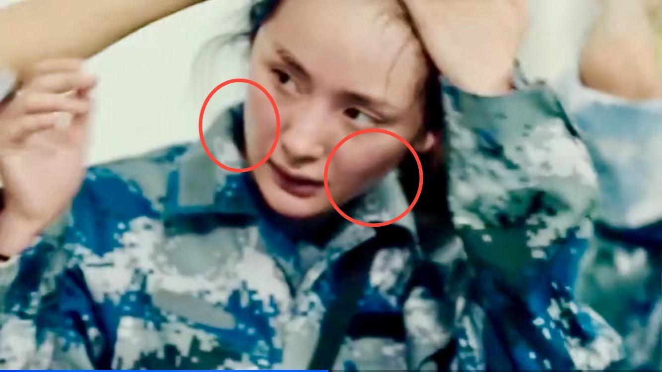 口水能过敏，天生没子宫，这6位明星的“隐疾”，有钱也治不好