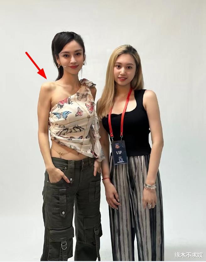 Angelababy线下活动受追捧,生图暴瘦到胸骨凸起,腿部伤痕令人心疼