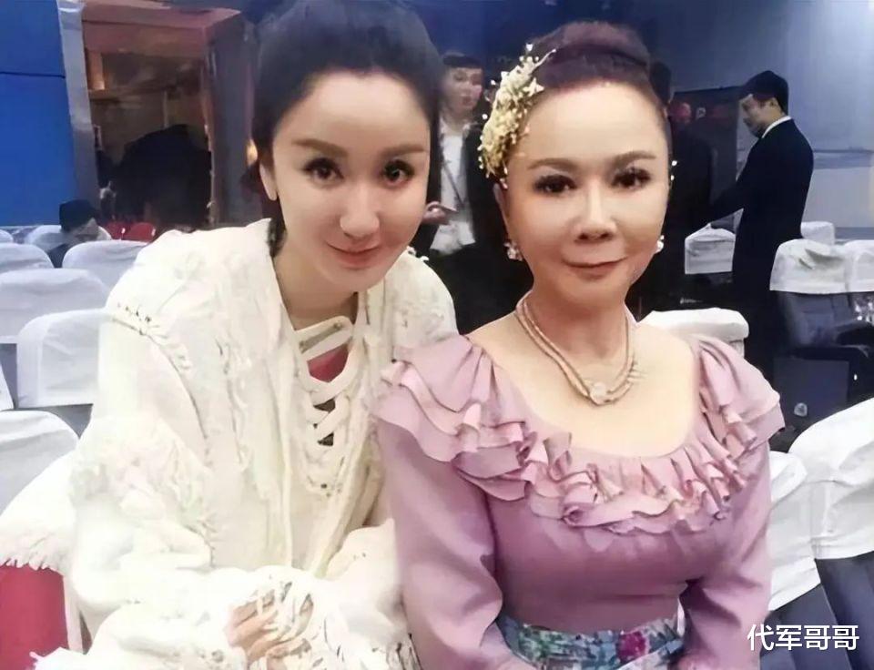 62岁的蔡明,终于为自己的“整容”付出了代价