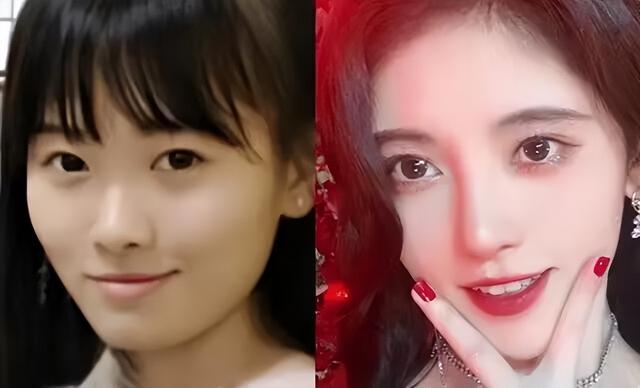 整容 当女明星们全变成“瓜子脸”，网友：难怪都去整容了！