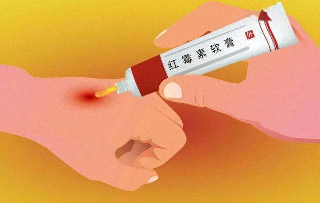 红霉素软膏,在眼部涂两下,身体会有什么变化?多数人可能不清楚