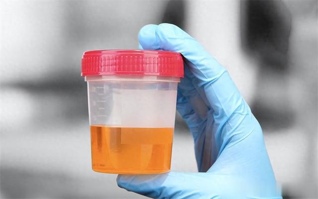 为何“尿毒症”越来越多？医生：3种水果别贪嘴，肾会“感激”你