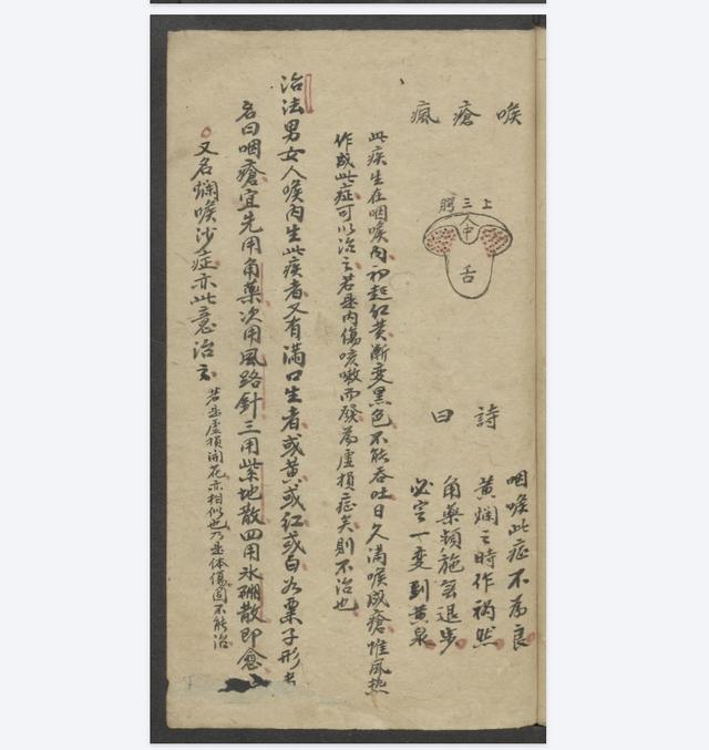 古籍分享《喉科秘傳》