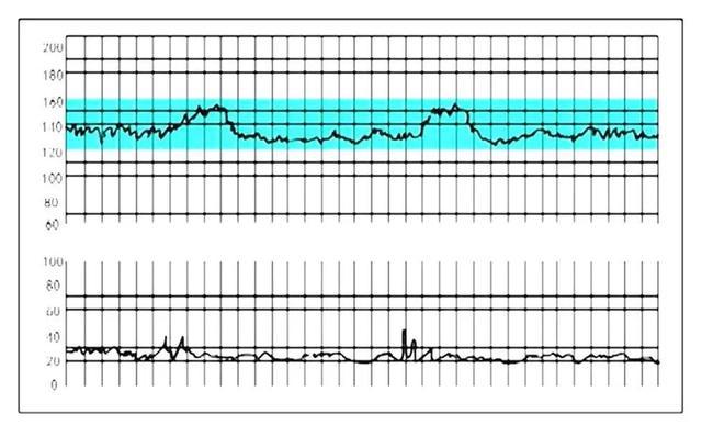 胎心率多少算正常? - 健康资讯(主打网)