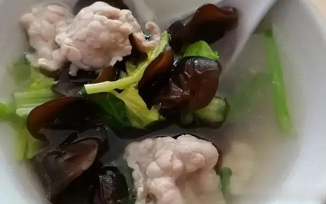 这4种食物是“血液清洁工”，时常端上桌，血管干净，血栓绕道走