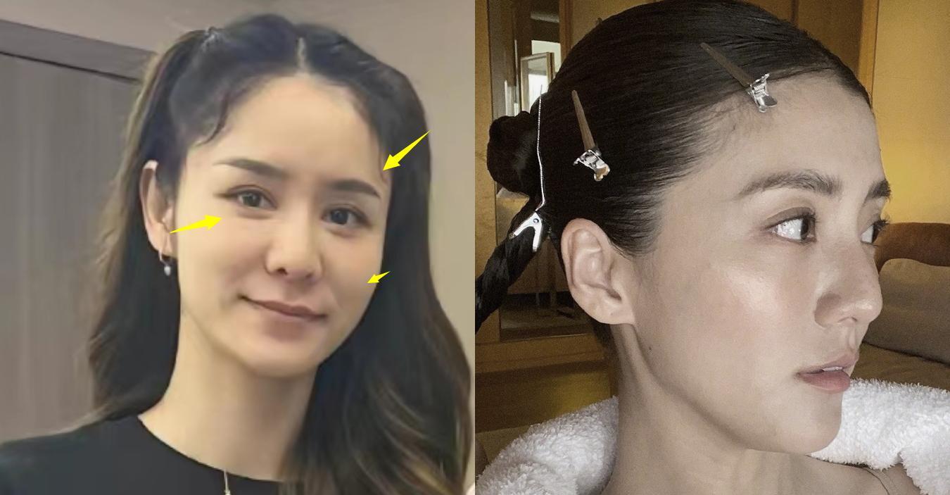 林峰妻子张馨月生照片曝光,毛孔粗大老10岁,和林峰发际线双双上移