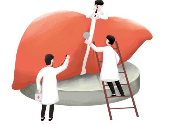 肝脏发出预警时，“手上”会有5个信号，有一个，建议尽快做肝CT