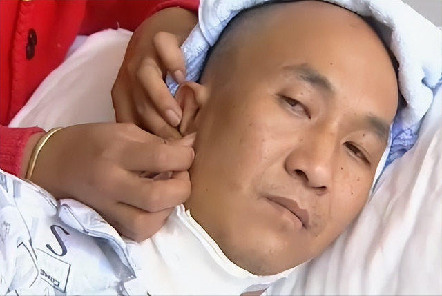 男子口臭骇人,每天刷牙数十遍都没用,检查发现颅内有10公分刀片