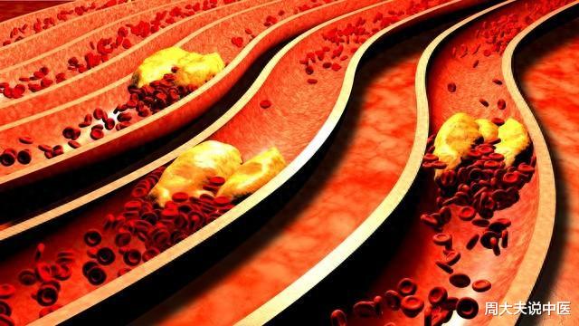 长期服用瑞舒伐他汀,身体会出现这6种变化,这些你要知道!