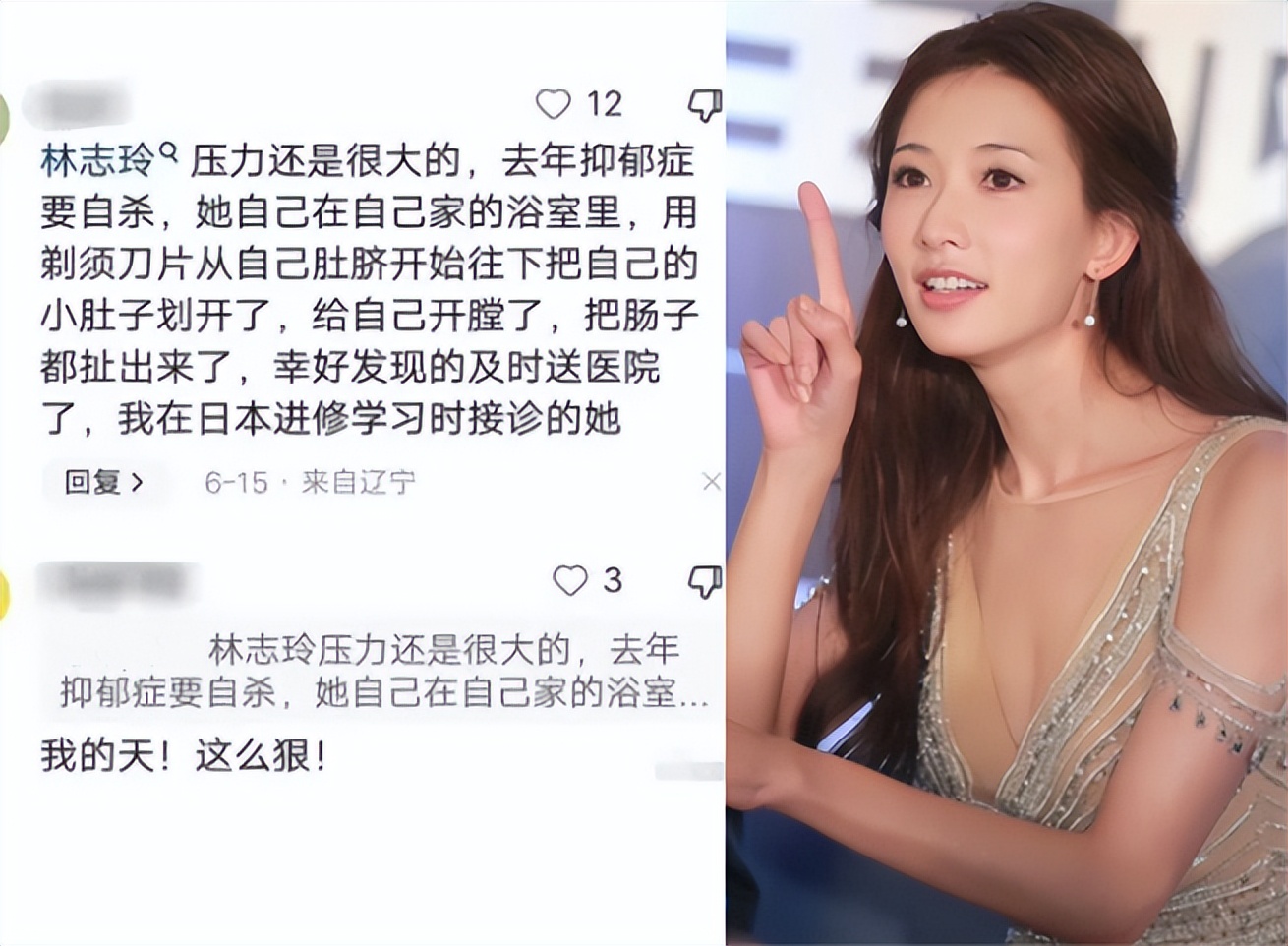 警惕微笑抑郁!曝林志玲自杀就医,手法比李玟残忍,曾被夫逼下跪