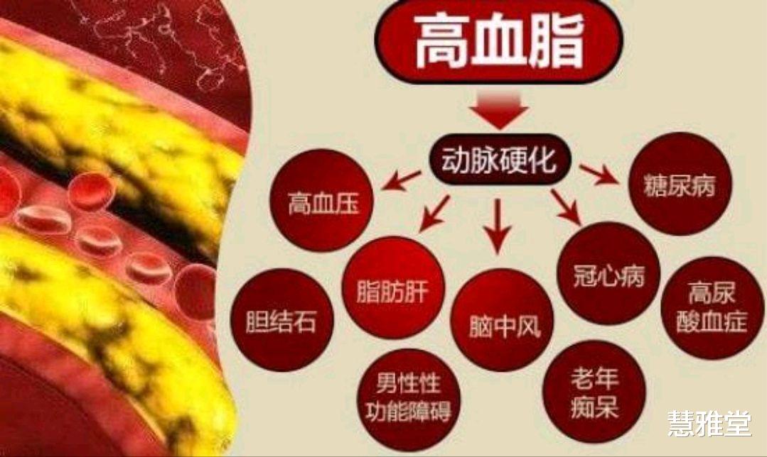 抗癌|高血脂是什么?若发现身体有3种异常,或许是在提醒你该降血脂了