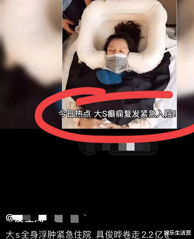 大S|传大S癫痫复发住院，具俊晔卷2.2亿跑路，原照曝光，网友：缺德