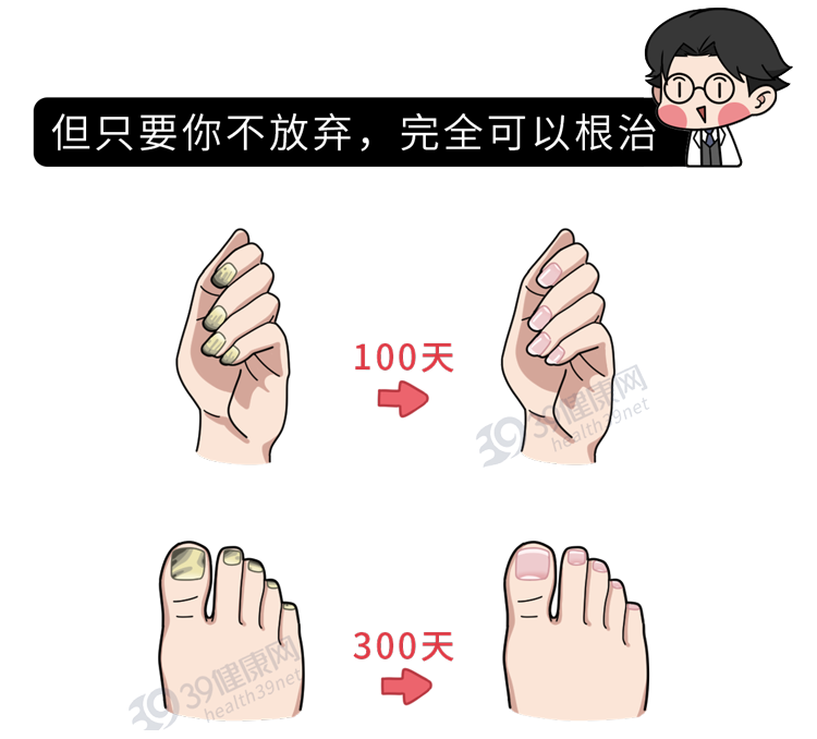 灰指甲|小脚趾的指甲分成两瓣，是纯种“汉族”的证明，这种说法靠谱吗？