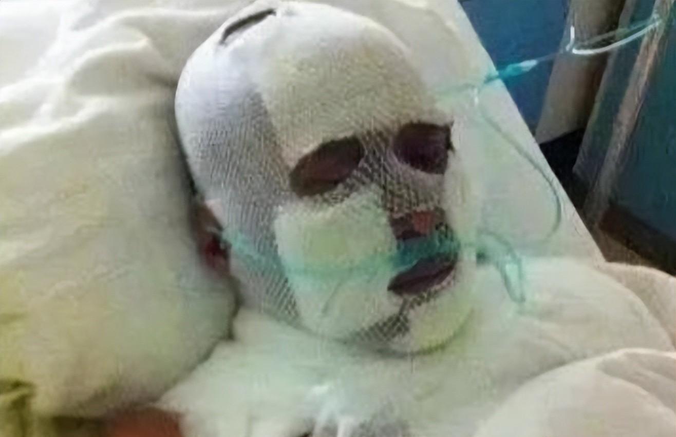 他因耍大牌被砍掉下巴,缝130针做5次手术,退圈卖马桶成富豪!