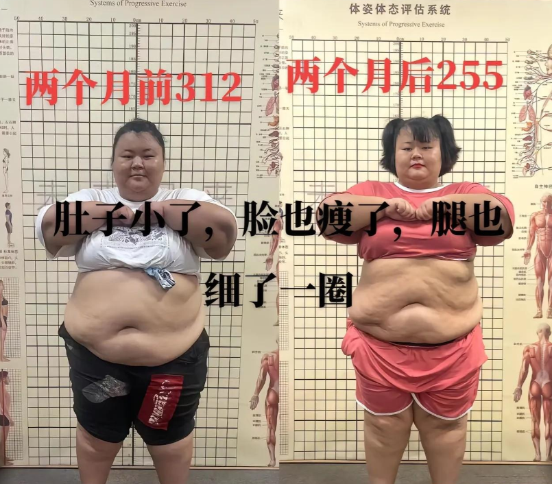 西瓜|悲痛!4天5位名人离世,失足坠楼、车祸、过度减肥,2人未满30岁