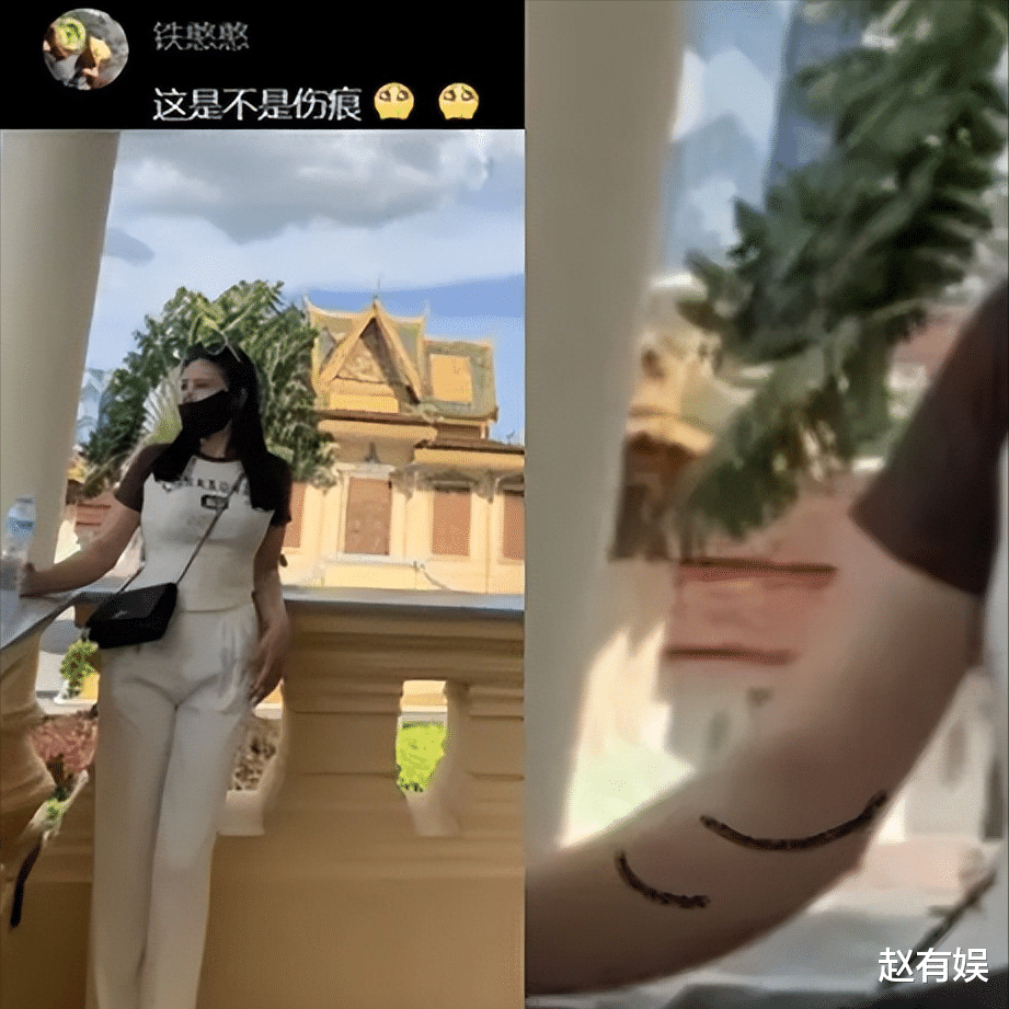 柬埔寨依晴出事了?晒性感美照露腰伤害,脖子上疑似有针孔