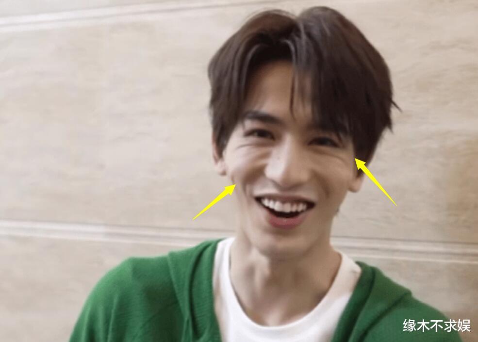 25岁张凌赫线下活动,身高190cm还穿增高鞋,生图面部崎岖不平