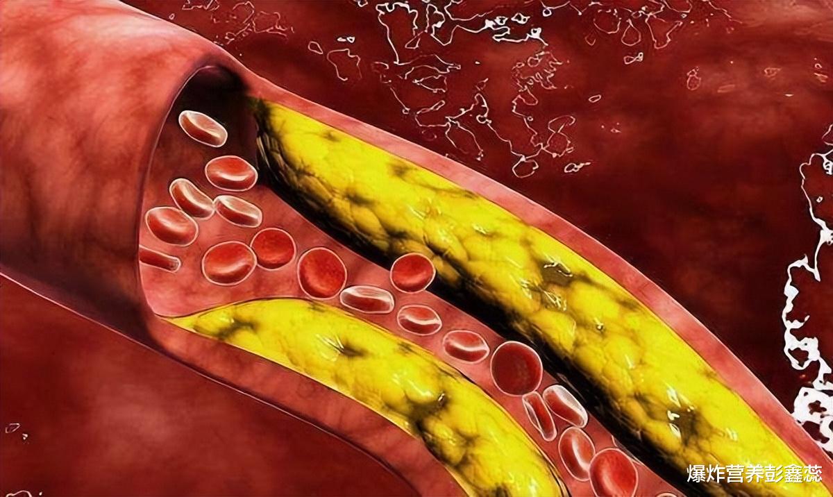 冬天长期吃“猪油”，可保护心脑血管？又有说植物油比猪油更健康