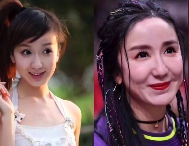 整容|“手工脸”是如何毁剧的?眼皮可捕虫、下巴能锄地,整得疼吗?