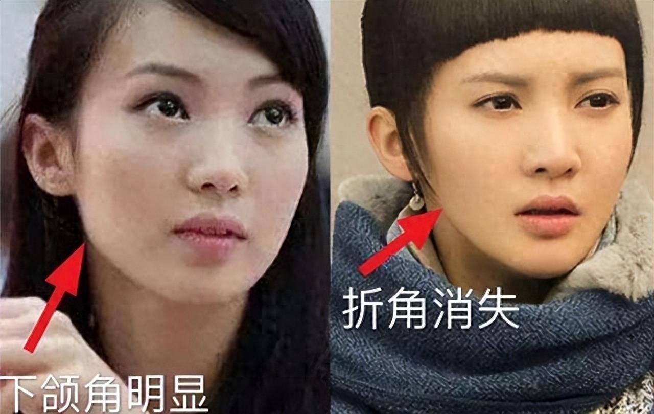 有种顽强叫“我没整容”!明明从大饼脸变成V脸,真当观众看不见