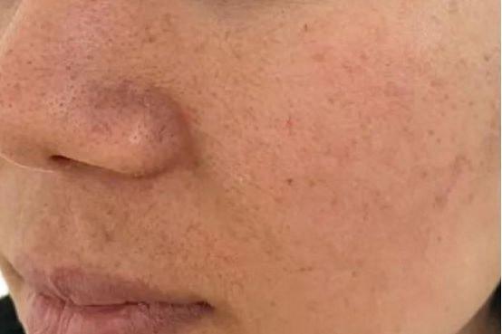 皮肤粗糙暗黄？教您几招儿，皮肤嫩滑白哲