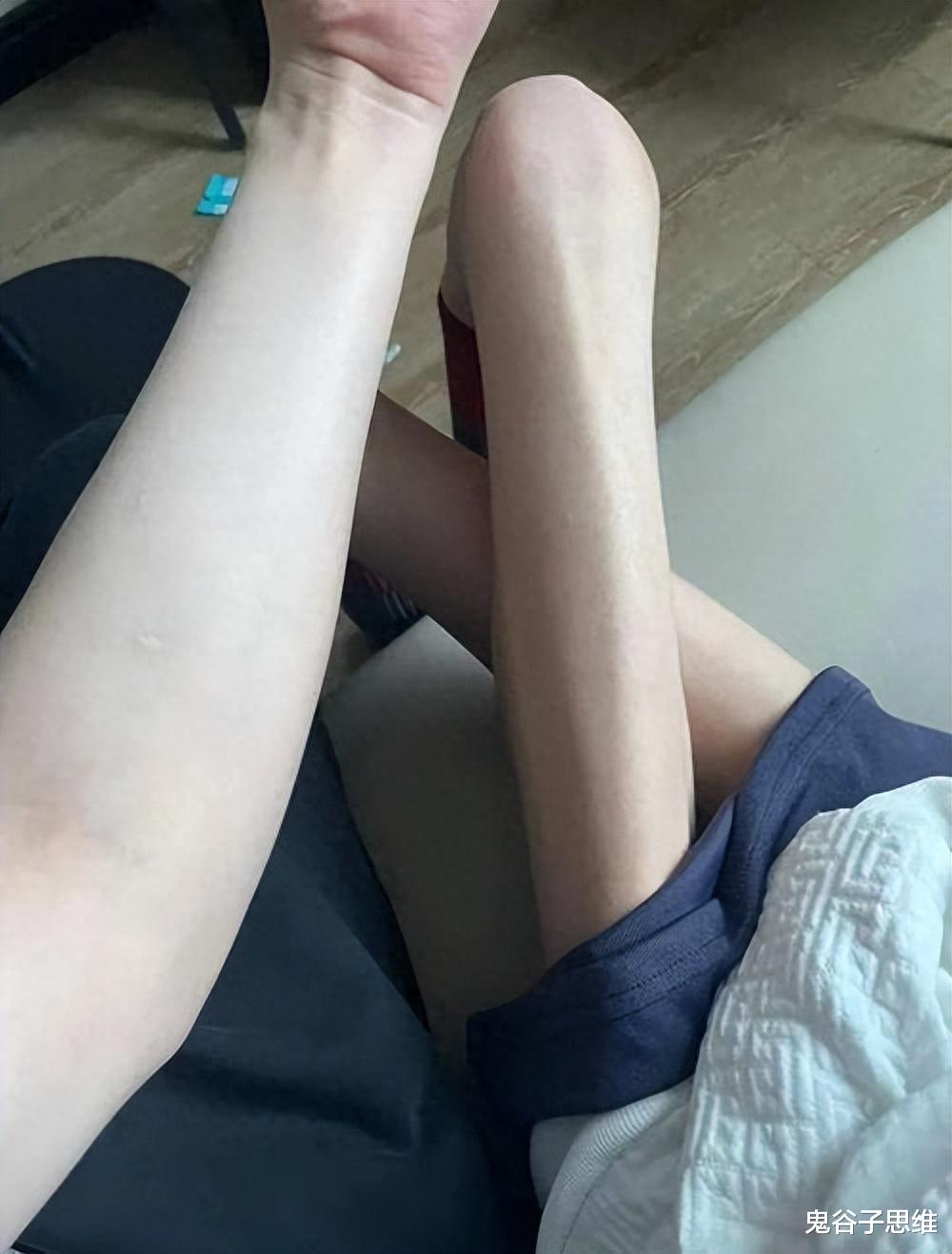 恋爱脑到底有多可怕,身高173的女孩为男友瘦到30公斤,值得吗?