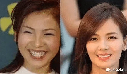 刘涛|44岁刘涛颜值回春,为何口碑却崩了?