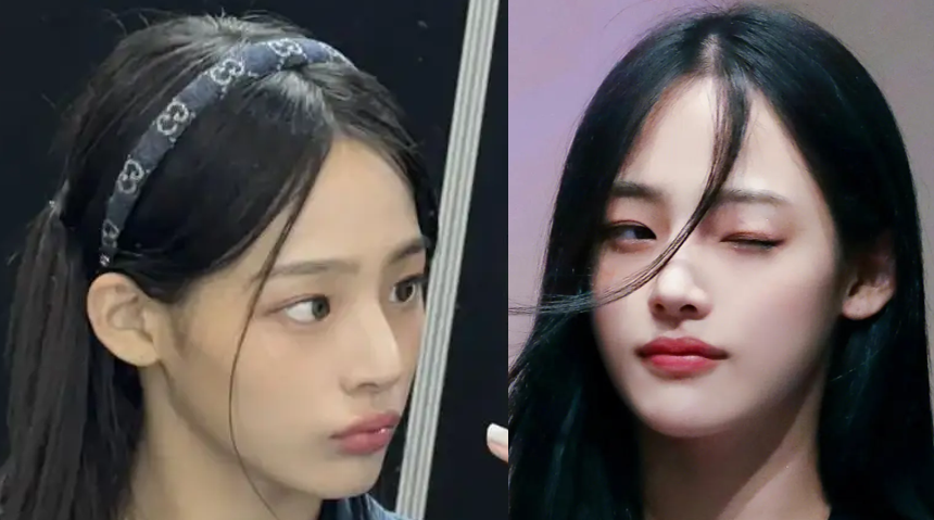 张雨绮的脸,怎么从千颂伊一夜间崩成蔡明了?