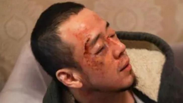 曝！歌手杨坤在长沙演出后被群打，鼻青脸肿，现场画面流出