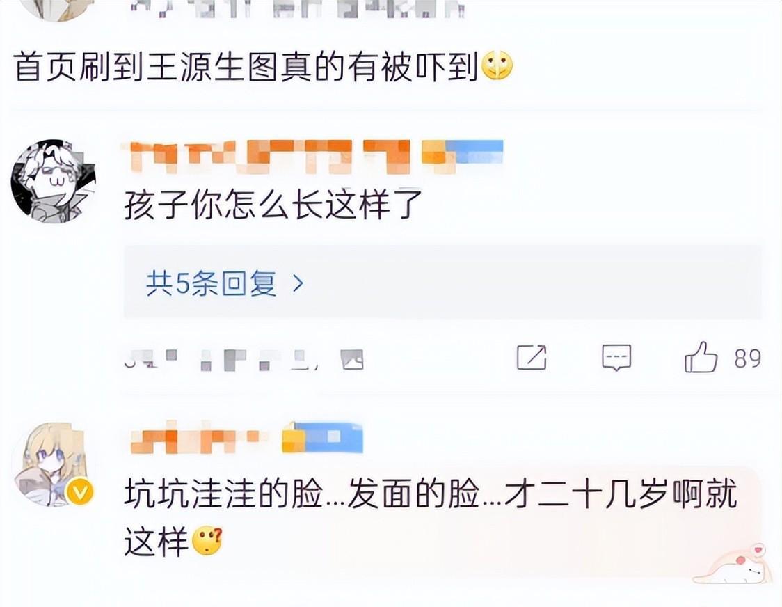 红楼梦|“完美男神”是假的，生图揭露“人间真实”脸型崎岖、满脸痘印