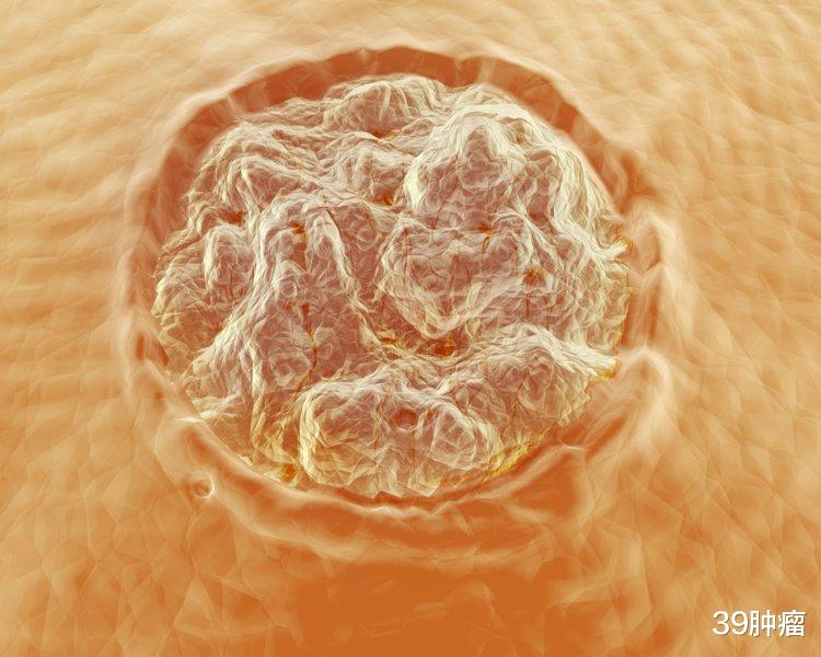 住院61天花掉104万，医院里烧钱式的ICU，收费真的合理吗？