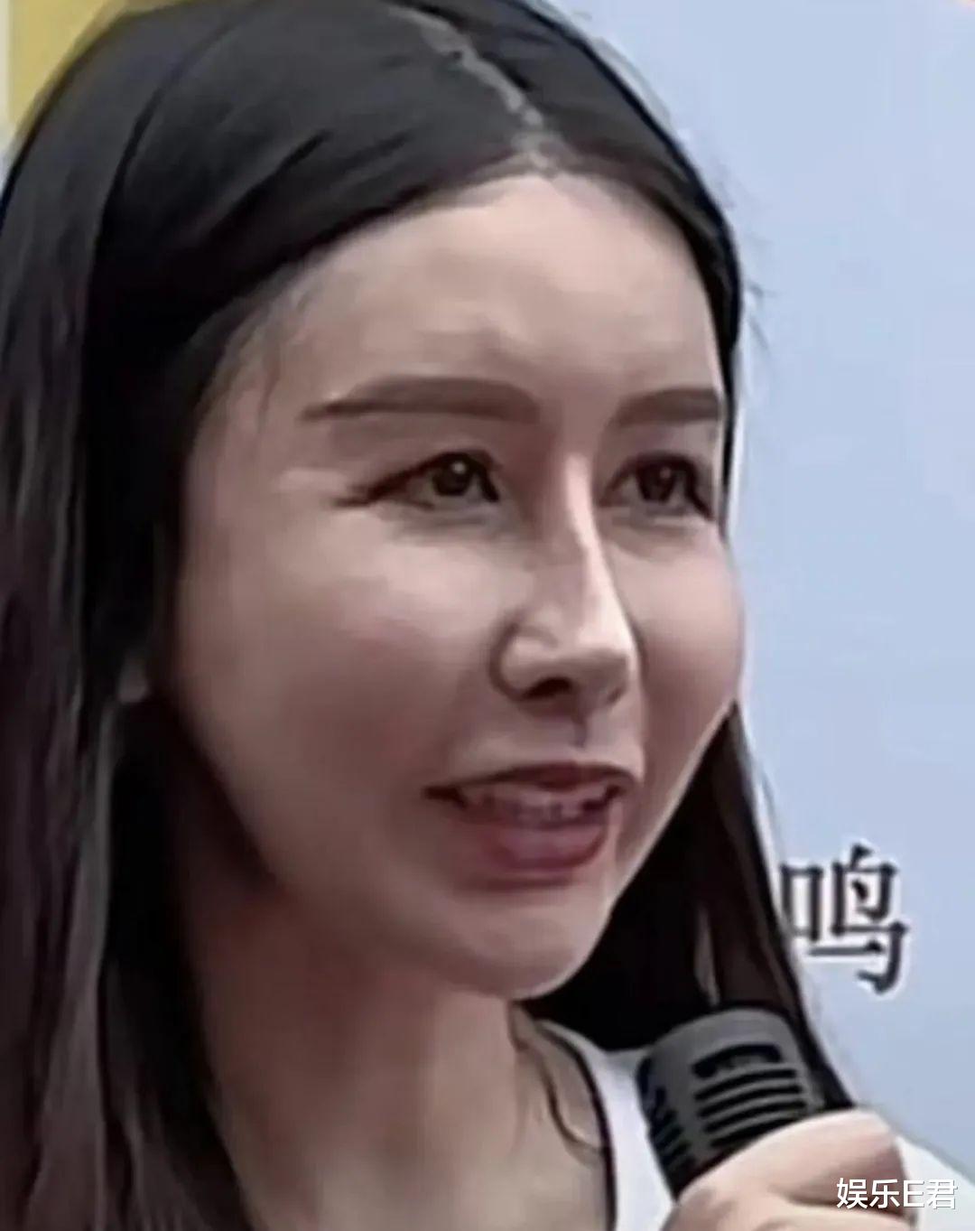 《夜空下的恋人》女主角被嘲“医美过度”,网友:猪八戒都比她好看