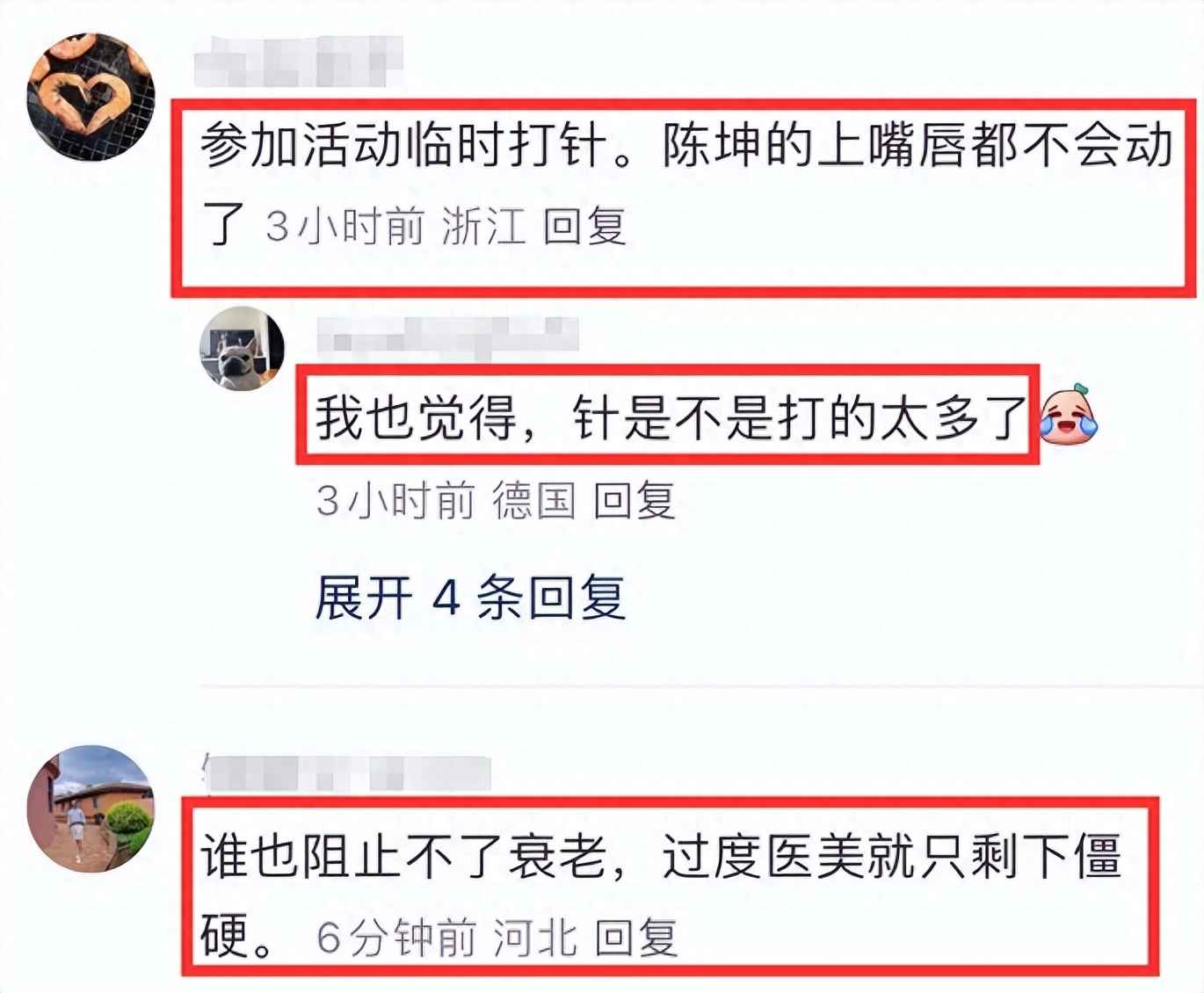 陈坤带儿子参加时装周,父子同框像兄弟,陈坤脸僵疑医美打针