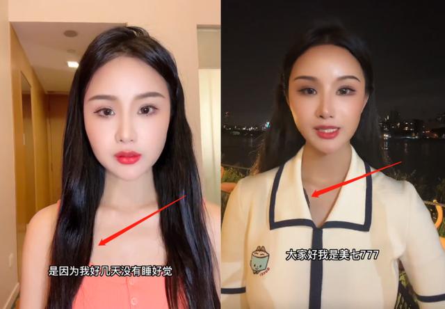 曝网红美七恐遇不测，官方警告AI合成，疑打针比110，视频是库存