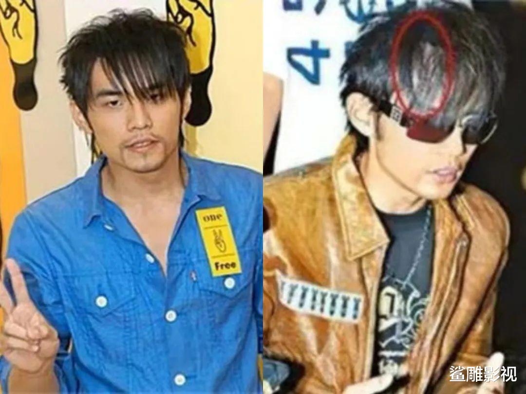 黄晓明为治秃头,花了多少冤枉钱