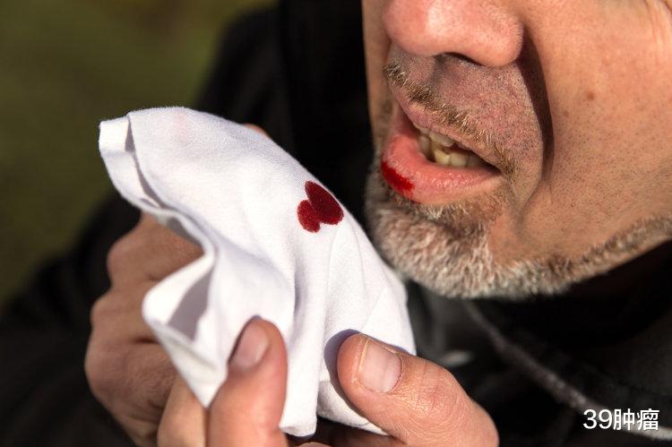 为什么中国越来越多人得肺癌?实话说:除了抽烟,还有这4大诱因